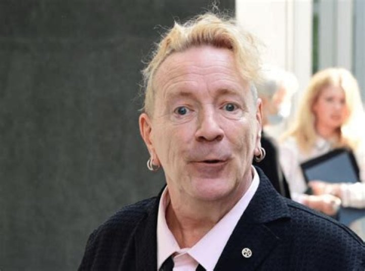 Did Johnny Rotten fix his teeth?